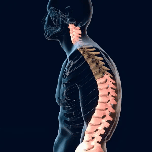 CORALINE™ Corrector De Postura